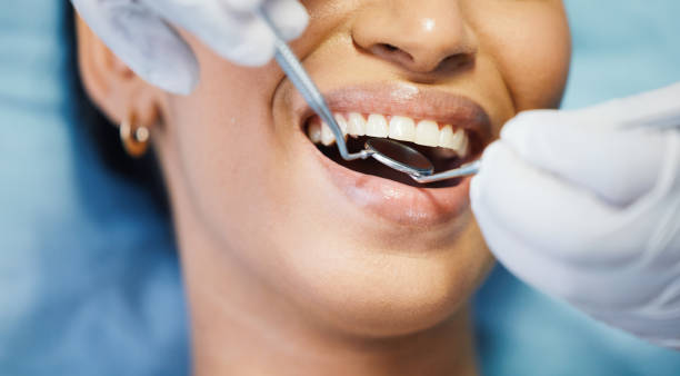 Best Broken or Cracked Tooth Emergency Dentist in Petersburg, MI