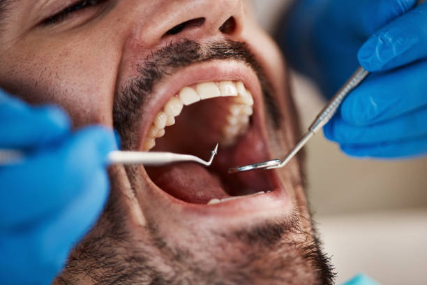 Best Emergency Dental Services for Seniors in Petersburg, MI